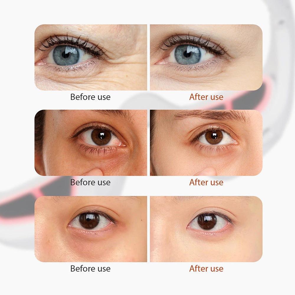 Riffora™ Microcurrent EMS Eye Beauty Massager